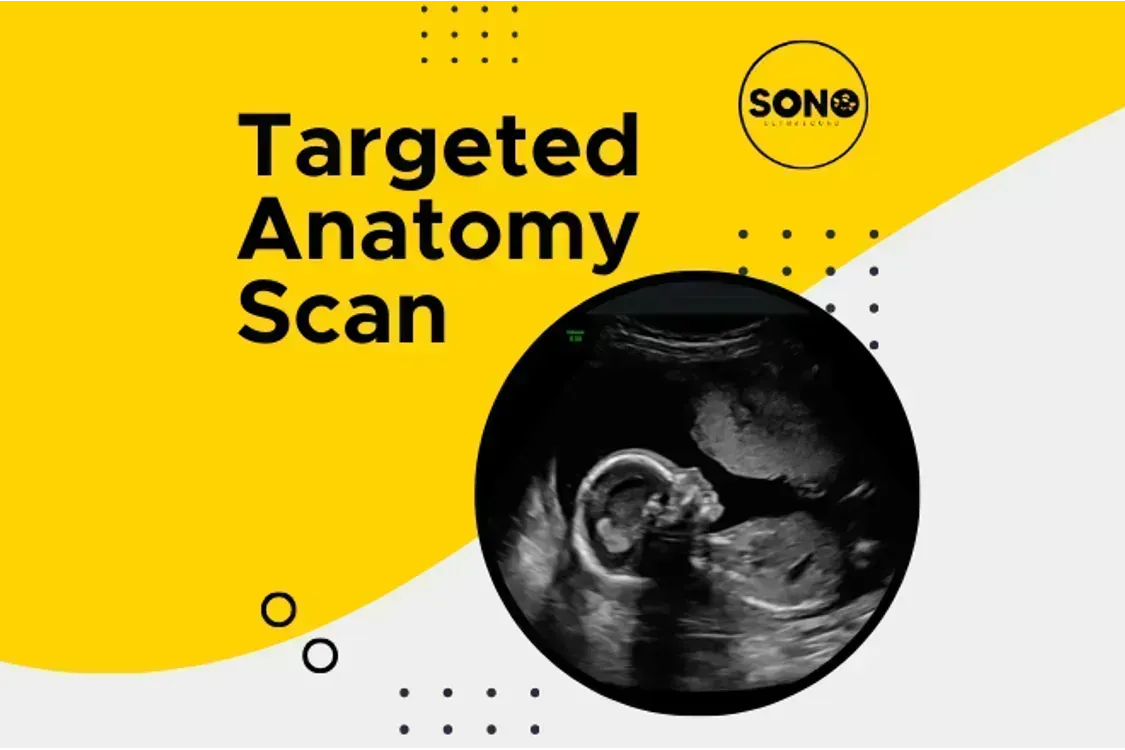 Targeted Scan